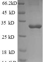 Saccharomyces cerevisiae Trehalose-phosphatase (TPS2), partial Recombinant Protein, N-His, aa 11–243 - BioCrest Sci