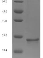 Mouse Osteocalcin (Bglap) Recombinant Protein, N-His-SUMO - BioCrest Sci