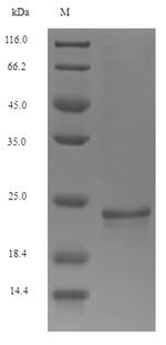 Mouse Osteocalcin (Bglap) Recombinant Protein, N-His-SUMO, Mus musculus (Mouse), E.coli, N-terminal 6xHis-SUMO-tagged, 21.1 kDa, purity >≥ 90% as determined by SDS-PAGE.