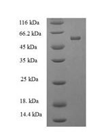 Human protein-tyrosine-phosphatase (PTPRR) Recombinant Protein, N-His-SUMO - BioCrest Sci