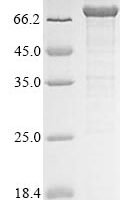 Human Probable ATP-dependent RNA helicase DDX53 (DDX53) Recombinant Protein - BioCrest Sci