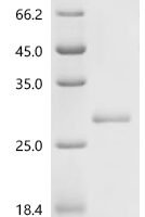 Mouse Gamma-interferon-inducible lysosomal thiol reductase (Ifi30) Recombinant Protein, C-His, aa 55–230, E.coli - BioCrest Sci