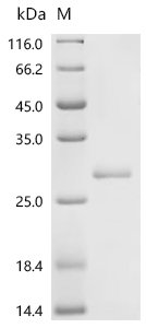 Mouse Gamma-interferon-inducible lysosomal thiol reductase (Ifi30) Recombinant Protein, C-His, aa 55–230, E.coli, Mus musculus (Mouse), E.coli, C-terminal 6xHis-tagged, 27.0 kDa, purity >≥ 90% as determined by SDS-PAGE.