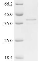 Human STEAP1 protein (STEAP1), partial Recombinant Protein - BioCrest Sci