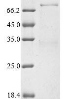 Human Deformed epidermal autoregulatory factor 1 homolog (DEAF1) Recombinant Protein, N-10His - BioCrest Sci