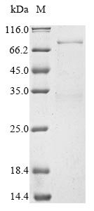 Human Deformed epidermal autoregulatory factor 1 homolog (DEAF1) Recombinant Protein, N-10His, Homo sapiens (Human), E.coli, N-terminal 10xHis-tagged, 65.4 kDa, purity >≥ 85% as determined by SDS-PAGE.