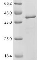 Human Protein arginine N-methyltransferase 1 (PRMT1), partial Recombinant Protein, C-His - BioCrest Sci