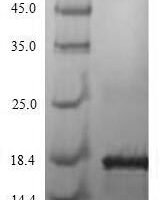 Human Kita-kyushu lung cancer antigen 1 (CT83) Recombinant Protein, N-His - BioCrest Sci