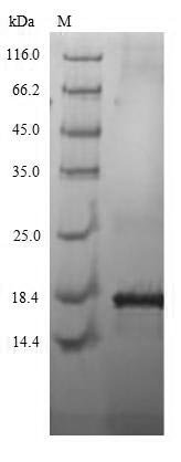 Human Kita-kyushu lung cancer antigen 1 (CT83) Recombinant Protein, N-His, Homo sapiens (Human), Mammalian cell, N-terminal 6xHis-tagged, 16.8 kDa, purity >≥ 90% as determined by SDS-PAGE.