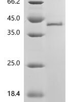 Mouse Fibronectin (Fn1), partial Recombinant Protein, N-His - BioCrest Sci