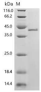 Mouse Fibronectin (Fn1), partial Recombinant Protein, N-His, Mus musculus (Mouse), E.coli, N-terminal 6xHis-tagged, 42.3 kDa, purity >≥ 95% as determined by SDS-PAGE.