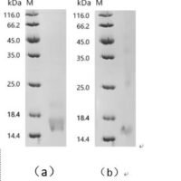 Human Metallothionein-2 (MT2A), partial Recombinant Protein, C-10His - BioCrest Sci