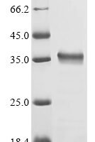 Porphyromonas gingivalis Gingipain R2 (rgpB), partial Recombinant Protein, N-His - BioCrest Sci
