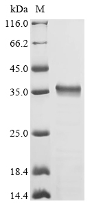 Porphyromonas gingivalis Gingipain R2 (rgpB), partial Recombinant Protein, N-His, Porphyromonas gingivalis (strain ATCC BAA-308 / W83), E.coli, N-terminal 6xHis-tagged, 33.3 kDa, purity >≥ 85% as determined by SDS-PAGE.