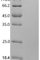 Human Integrin alpha-M (ITGAM), partial Recombinant Protein, N-His - BioCrest Sci