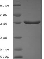 Sheep Protransforming growth factor alpha (TGFA), partial Recombinant Protein, N-GST, aa 24–97, E.coli - BioCrest Sci