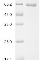 Ustilaginoidea virens Phosphoacetylglucosamine mutase Recombinant Protein, C-His, aa 1–538, E.coli - BioCrest Sci