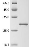 Human E3 ubiquitin-protein ligase RNF130 (RNF130), partial Recombinant Protein - BioCrest Sci