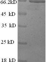 Human Extracellular calcium-sensing receptor (CASR), partial Recombinant Protein, N-His - BioCrest Sci