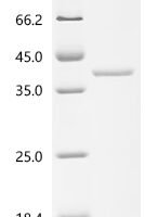 Escherichia coli Chaperedoxin (cnoX) Recombinant Protein - BioCrest Sci