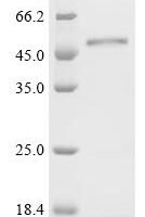 Human Androgen receptor(AR),partial Recombinant Protein - BioCrest Sci