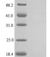 Mouse Neuropeptide Y receptor type 2 (Npy2r), partial Recombinant Protein, N-10His - BioCrest Sci
