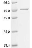 Anisakis simplex Tropomyosin Recombinant Protein, N-10His/C-Myc - BioCrest Sci