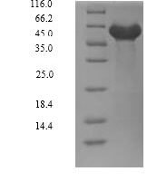 Human Dual specificity tyrosine-phosphorylation-regulated kinase 2 (DYRK2), partial Recombinant Protein - BioCrest Sci