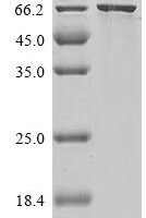 Human Asparagine synthetase [glutamine-hydrolyzing] (ASNS) Recombinant Protein - BioCrest Sci