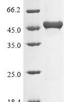 Escherichia coli 3-demethoxyubiquinol 3-hydroxylase (ubiF) Recombinant Protein - BioCrest Sci
