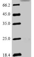 Human Semaphorin-3F (SEMA3F) Recombinant Protein - BioCrest Sci