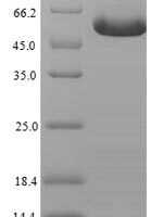 Human GDNF family receptor alpha-like (GFRAL), partial Recombinant Protein - BioCrest Sci