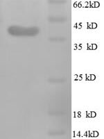 Human Midkine (MDK) Recombinant Protein - BioCrest Sci