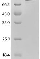 Human Ubiquitin carboxyl-terminal hydrolase 15 (USP15), partial Recombinant Protein - BioCrest Sci