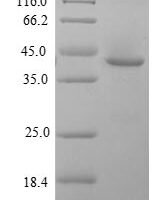 Human Zinc finger protein GLI2 (GLI2), partial Recombinant Protein, N-His-SUMO - BioCrest Sci