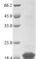 Trypanosoma cruzi Kinetoplastid membrane protein 11 (KMP-11) Recombinant Protein - BioCrest Sci