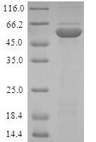 Human DNA oxidative demethylase ALKBH2 (ALKBH2) Recombinant Protein, N-GST - BioCrest Sci