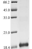 Phoneutria nigriventer Omega-ctenitoxin-Pn3a Recombinant Protein - BioCrest Sci