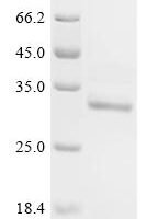 Pig High mobility group protein B1 (HMGB1) Recombinant Protein - BioCrest Sci
