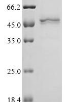Hamster polyomavirus Major capsid protein VP1 Recombinant Protein - BioCrest Sci