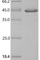 Human Protein boule-like (BOLL) Recombinant Protein, C-His - BioCrest Sci