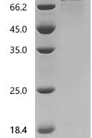 Mouse Semaphorin-4B (Sema4b), partial Recombinant Protein, C-hFc1 - BioCrest Sci