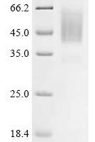 Varicella-zoster virus Envelope glycoprotein B (gB), partial Recombinant Protein, C-hFc1 - BioCrest Sci