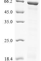 Human Cytochrome P450 4F8 (CYP4F8), partial Recombinant Protein, N-10His/C-Myc - BioCrest Sci