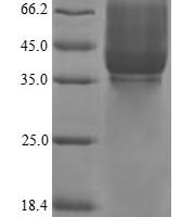 Pig Cadherin-3 (CDH3) Recombinant Protein - BioCrest Sci