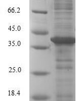 Human Galectin-2 (LGALS2) Recombinant Protein - BioCrest Sci