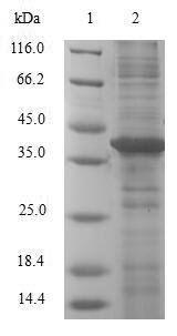 Human Galectin-2 (LGALS2) Recombinant Protein, Homo sapiens (Human), E.coli, N-terminal GST-tagged, 41.6 kDa, purity >≥ 90% as determined by SDS-PAGE.
