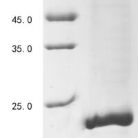 Human Agouti-signaling protein (ASIP) Recombinant Protein, N-10His/C-Myc - BioCrest Sci