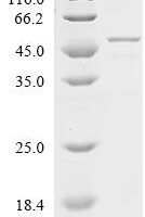 Human Endoplasmic reticulum resident protein 29 (ERP29) Recombinant Protein, N-GST - BioCrest Sci