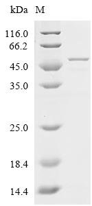 Human Endoplasmic reticulum resident protein 29 (ERP29) Recombinant Protein, N-GST, Homo sapiens (Human), Yeast, N-terminal GST-tagged, 52.0 kDa, purity >≥ 85% as determined by SDS-PAGE.